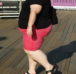 obese woman